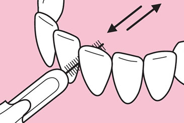 Interdentalbürsten Nutzung