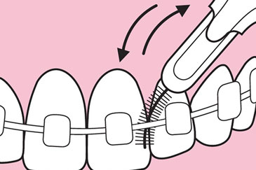 Interdentalbürsten Nutzung