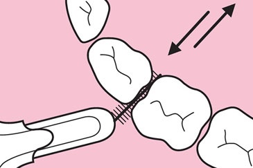 Interdentalbürsten Nutzung